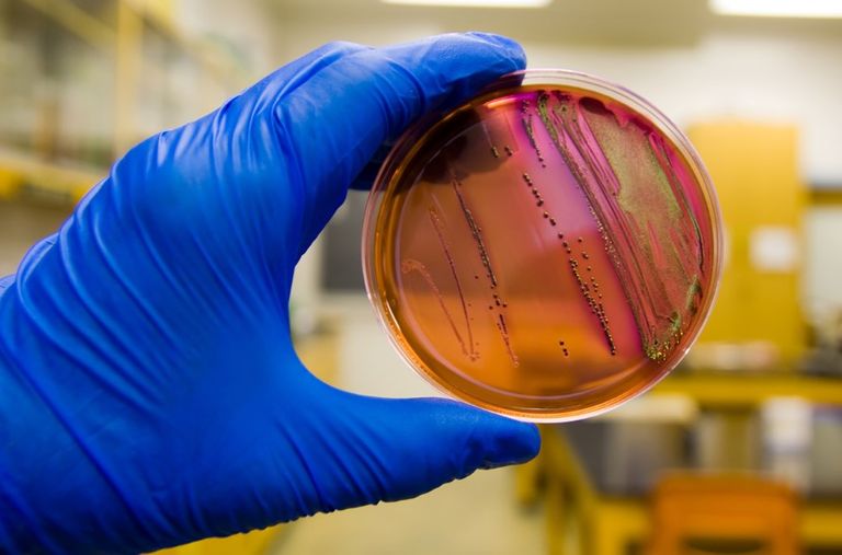 المياه الملوثة أحد مصادر الإصابة بالبكتيريا