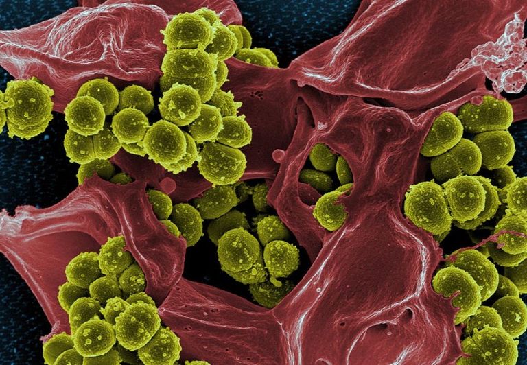 ميكروبيوم الأمعاء