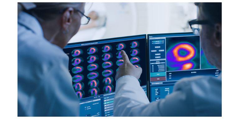 أهمية التصوير المقطعي بالإصدار البوزيتروني (PET)