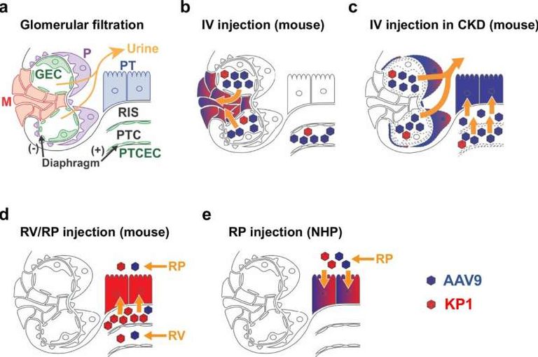 اختراق في العلاج الجيني لأمراض الكلى