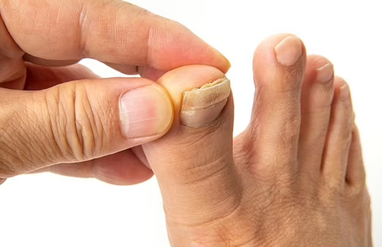 الجمعية الكندية جمعت قصاصات أظافر من 30 ألف مواطن