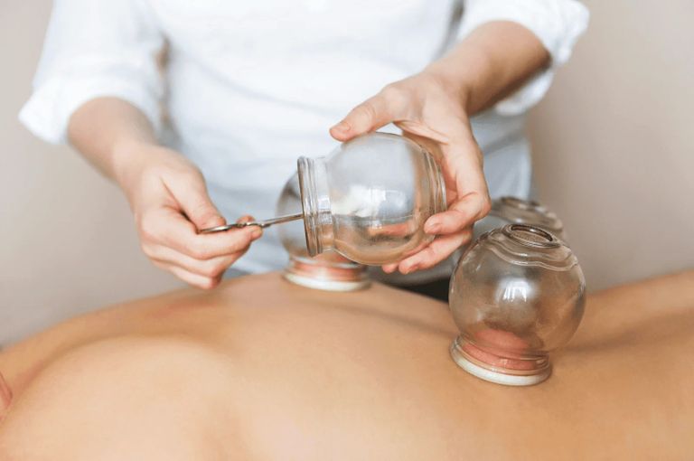 العلاج بالحجامة