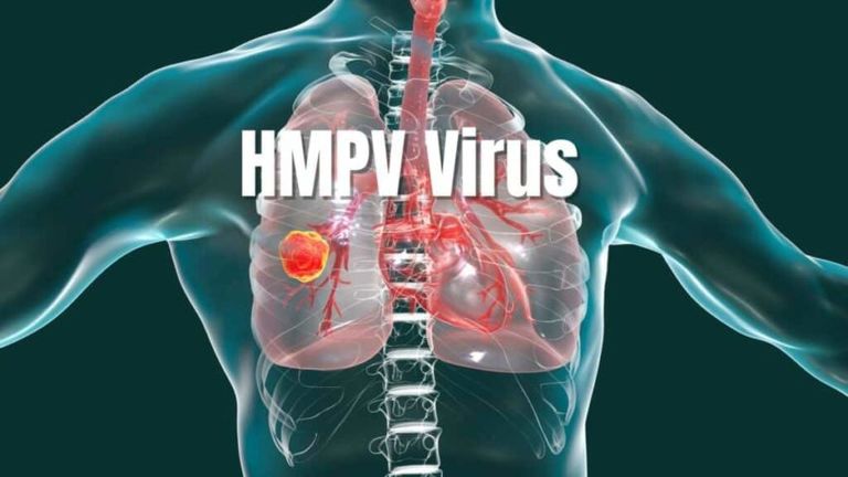 الفيروس الرئوي البشري HMPV