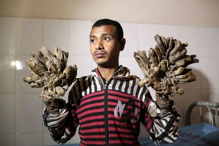 أطفال القمر 