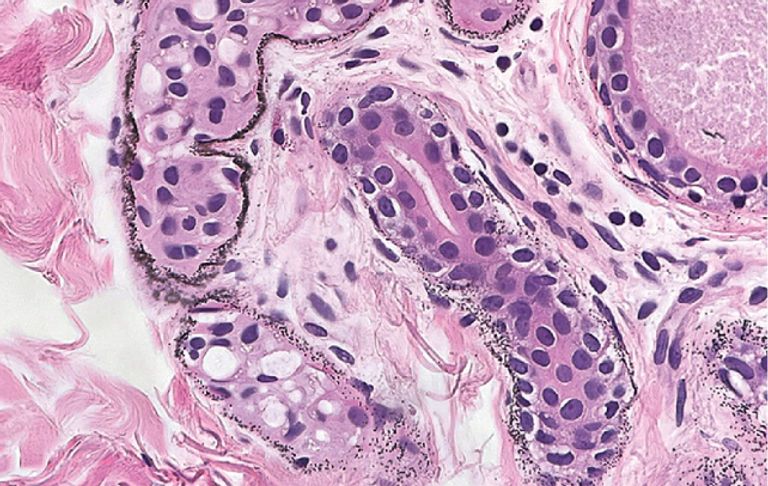 رجل بجلد رمادي