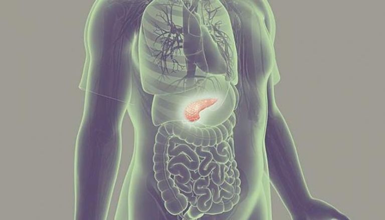 ثورة جديدة في علاج سرطان البنكرياس باستهداف الخلايا المساندة