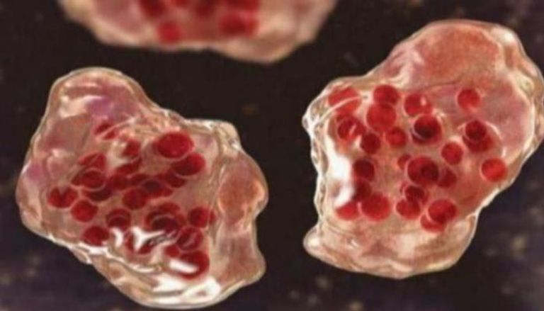 لقاح الحصبة