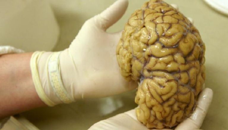 اكتشاف خلايا دماغية تحب الغموض
