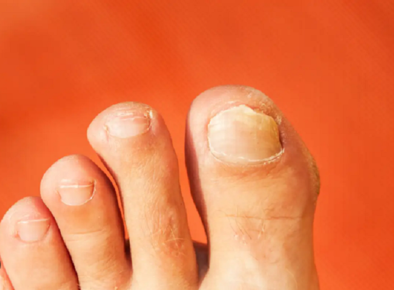 باحثون يجمعون قصاصات أظافر القدم للتحليل