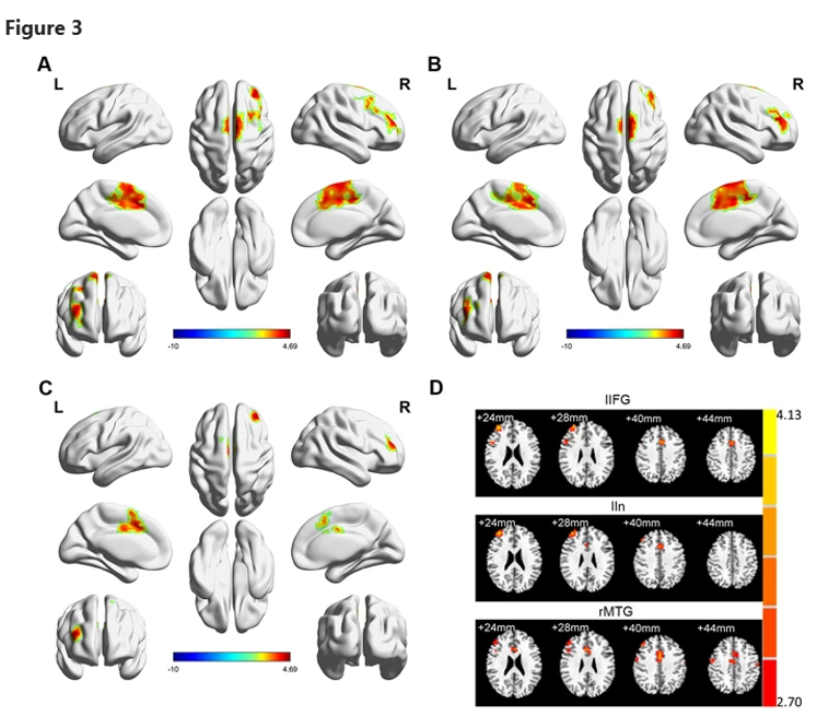 الباحث كريستيان جنسن يرتدي سماعة الرأس عالية الكثافة لمشروع LDAEP