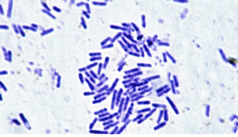 اكتشاف بكتيريا تحطم حدود الفضاء