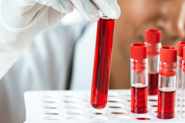 متلازمة بارث