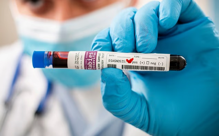 طبيب يوصي بأربعة فحوصات دم ضرورية بعد سن الأربعين