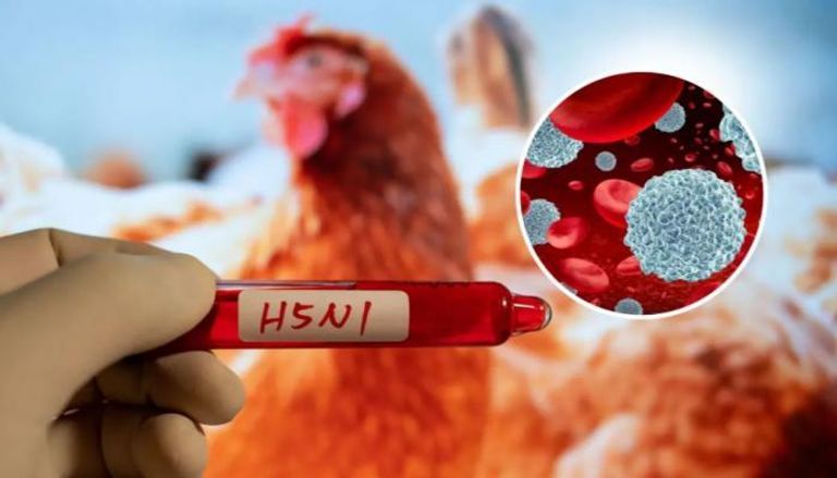 إنفلونزا الطيور