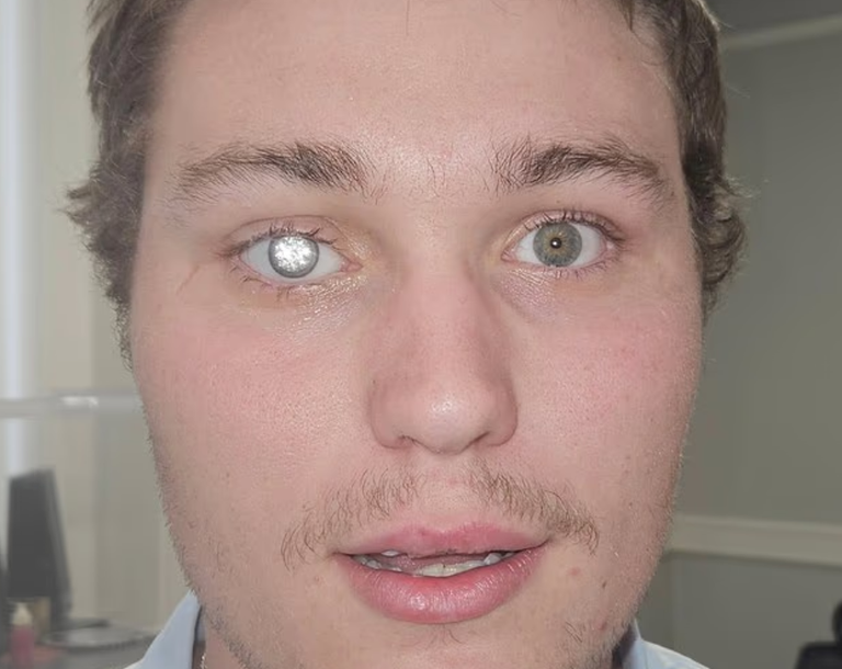 تاجر مجوهرات يزرع ألماسة في عينه الصناعية