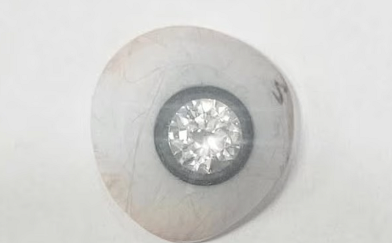 تاجر مجوهرات يزرع ألماسة في عينه الصناعية