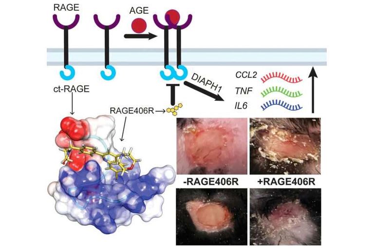 علاج تجريبي ينهي مشكلة جروح السكري المزمنة