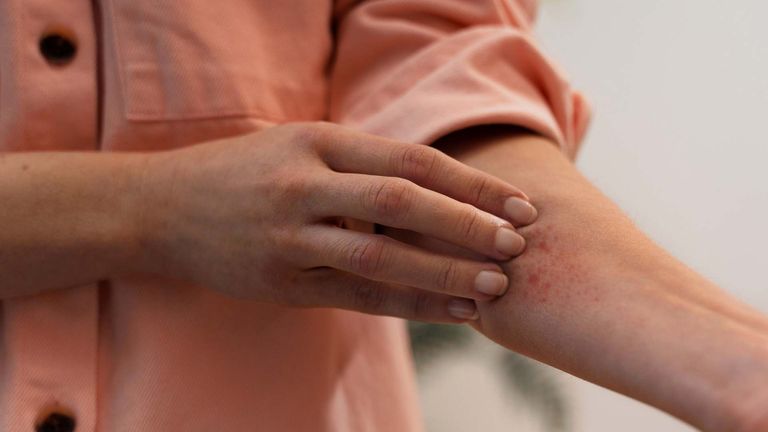 كشف الخريطة الجينية لمرض بهجت في مصر وتونس والمغرب