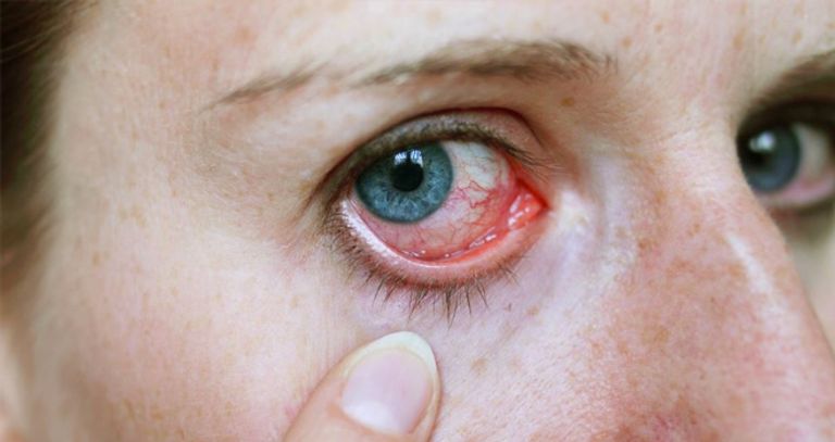 كشف الخريطة الجينية لمرض بهجت في مصر وتونس والمغرب