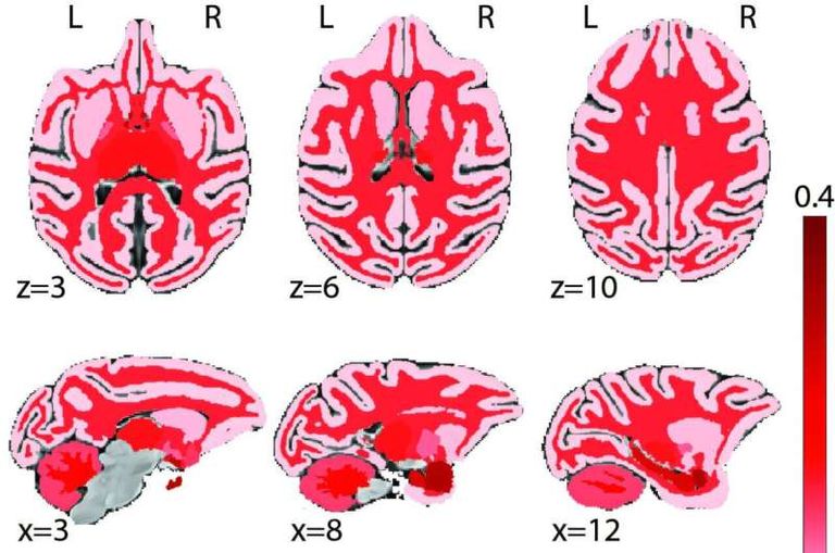 كشف سر النضوج العقلي في سن المراهقة