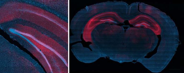 الطريقة المبتكرة تستخدم مزيجا من الموجات فوق الصوتية والعلاج الجيني