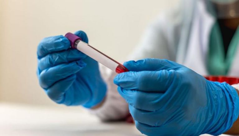 علماء روس يبتكرون تقنية تعزز فعالية علاج سرطان الدم