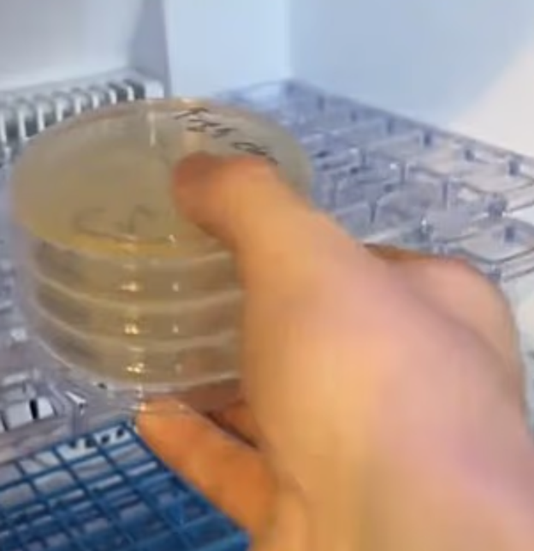 فيديو صادم يكشف كمية البكتيريا التي تعيش على شريحة البيتزا المتبقية