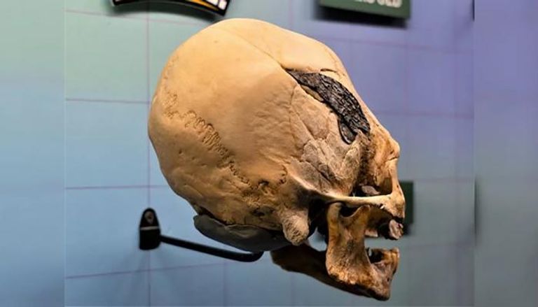 جمجمة بشرية