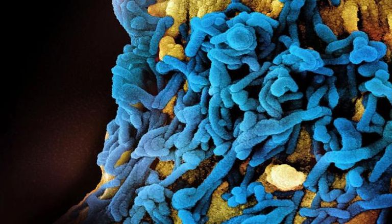 تفاصيل انتشار فيروس ماربورغ في إثيوبيا