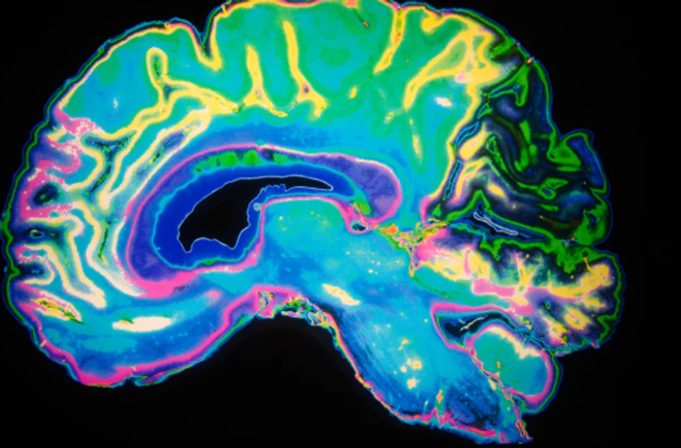 الرضع الذين يولدون بعمى مبكر في كلتا العينين يمكنهم استعادة الرؤية