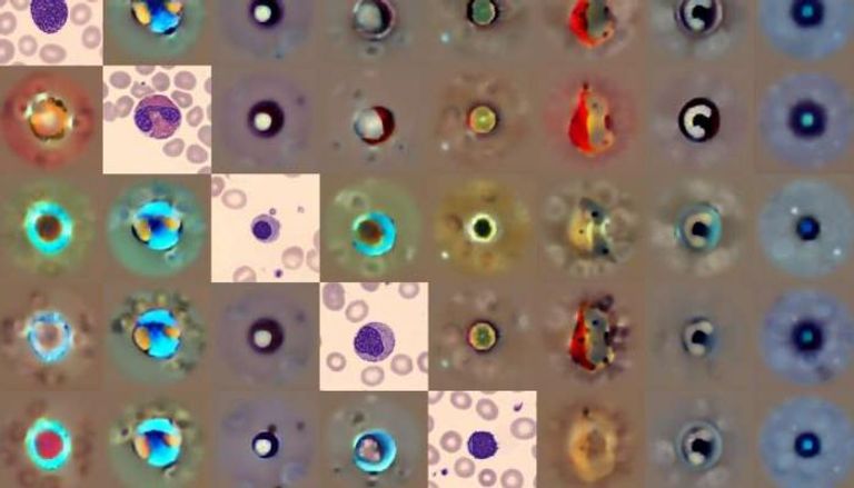 أنواع مختلفة من خلايا الدم حُللت باستخدام اسم آداة "نموذج الانتشار الخلوي"