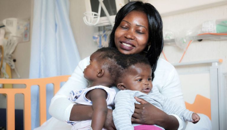 اليوم العالمي للتوأم الملتصق 2025