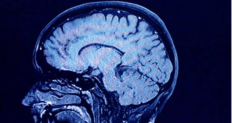 علماء كامبريدج يحددون خمس مراحل يمر بها الدماغ