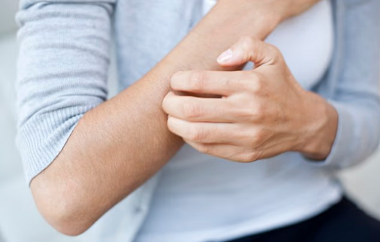 حكة الجلد قد تكون مؤشرا لأمراض خفية