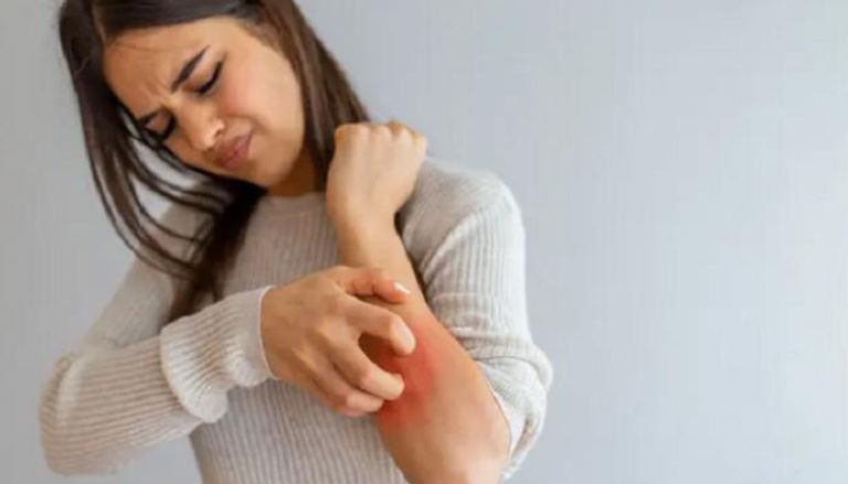 حكة الجلد قد تكون مؤشرا لأمراض خفية