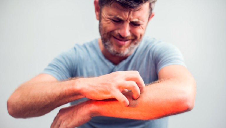 حكة الجلد قد تكون مؤشرا لأمراض خفية