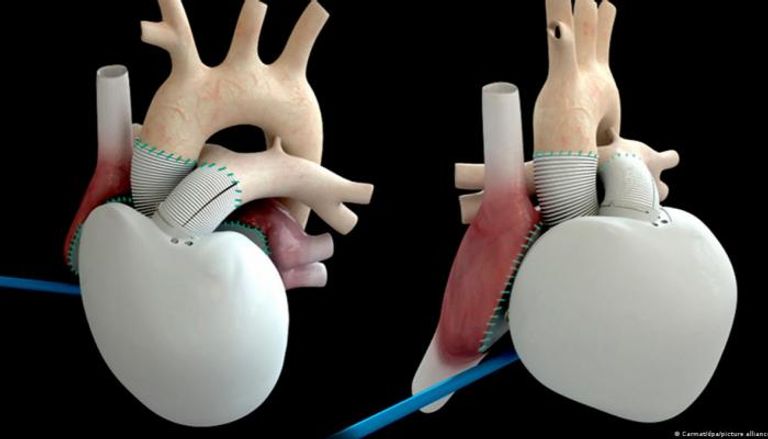 القلب الاصطناعي