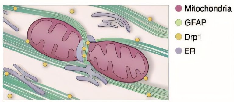 مرض إلكسندر، اضطراب وراثي يؤدي تدريجيًا إلى تدهور وظائف الدماغ
