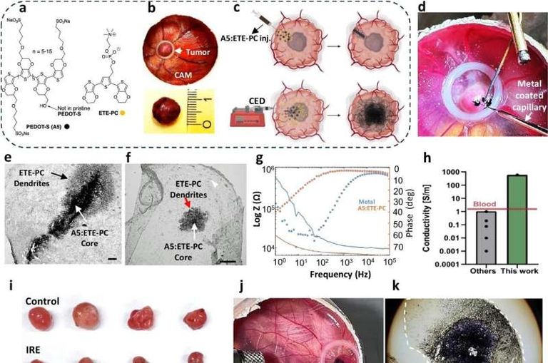 علاج كهربائي واعد بالجسيمات النانوية لأورام الدماغ
