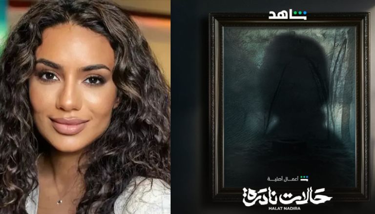 كواليس مسلسل حالات نادرة السعودي