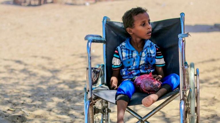 حرب الحوثي ومعاناة الأشخاص ذوي الهمم في اليمن