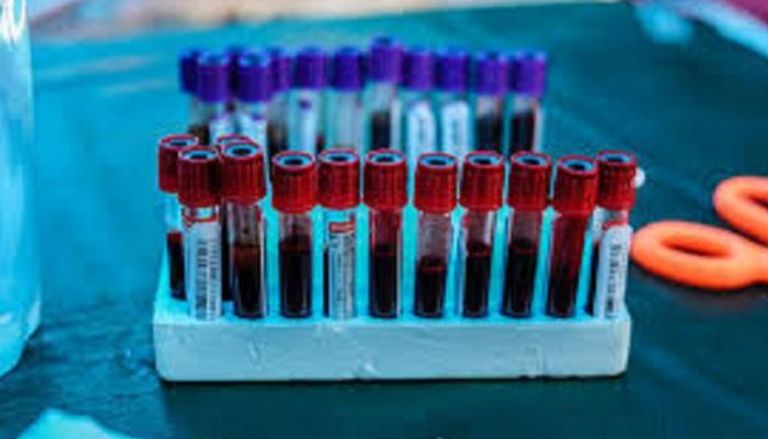 اختبار دم يكشف سرطان الرئة من خلية واحدة