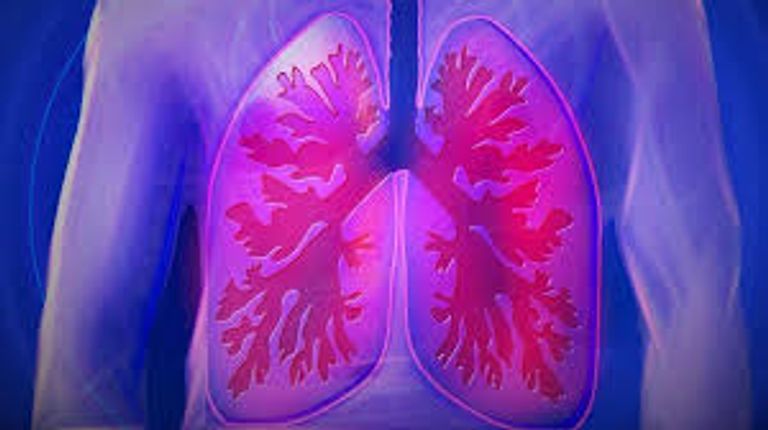 اختبار دم يكشف سرطان الرئة من خلية واحدة