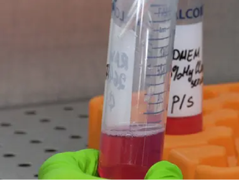 فحوصات لدماء ملوثة بعنصر اليورانيوم