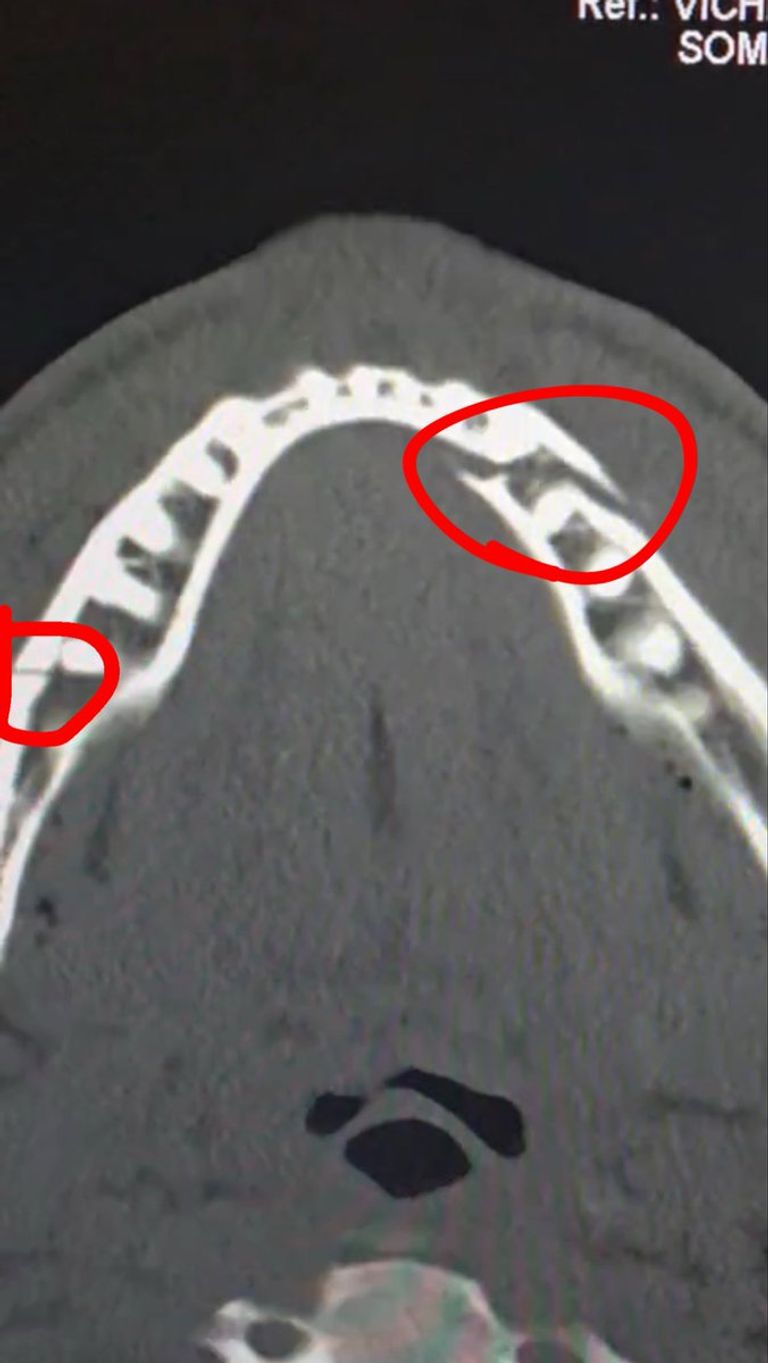 جاك بول يخسر نزاله أمام أنطوني جوشوا