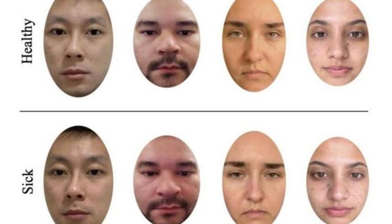 دراسة علمية تكشف أن النساء أكثر دقة من الرجال في تشخيص المرض من الوجوه