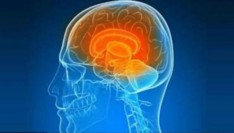 اكتشاف ارتباط الفصام بإفراز السيروتونين يمنح العلماء هدفا علاجيا جديدا 