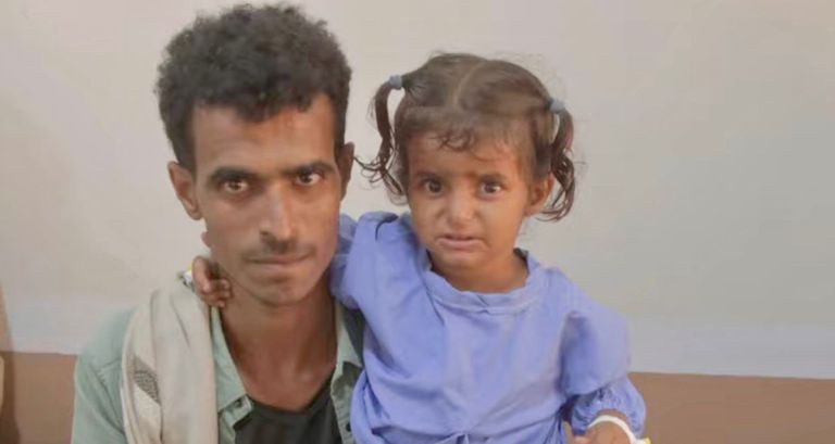 عملية جراحية تنقذ طفلة يمنية بجهود إماراتية