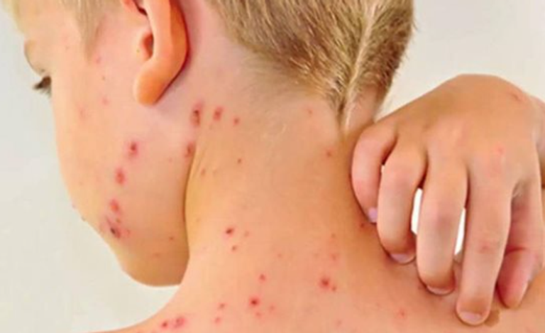 شهد عام 2025 انتشارا واسعا لما يمكن تسميته بـ"الأوبئة الصامتة".