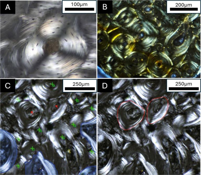 العظام الثانوية وحدات دقيقة في العظام 